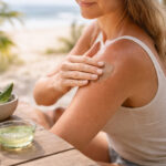 Persoana aplicand aloe vera pe piele pentru calmarea arsurilor solare